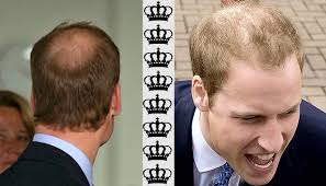 Prince william 'is already thinking' about how he wants to 'modernize' the monarchy as king. Lysiejesz Pogodz Sie Z Tym