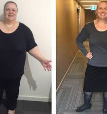 Womans Amazing 100kg Weight Loss In 11 Months Nz Herald