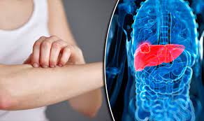 What are the main causes of primary liver cancer? Liver Cancer Symptoms Nine Signs You Could Be Suffering With Disease Express Co Uk