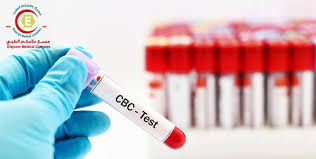 White blood cell (wbc, leukocyte) count. Cbc Test With A Free Medical Checkup Cobone Offers