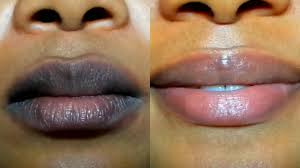 get natural pink lips in 3 days of