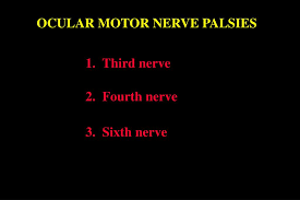 Ppt Ocular Motor Nerve Palsies Powerpoint Presentation