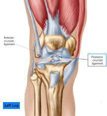 A torn ligament severely limits knee movement. Pcl Injuries What Happens And What Treatment Options Are Available