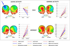 4 images 1 mot : Eeg Changes Reflecting Pain Is Alpha Suppression Better Than Gamma Enhancement Sciencedirect