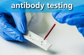 antibody testing for covid 19 hsc