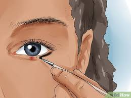 how to get rid of a stye 11 steps