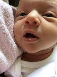 newborn dry lips babycenter