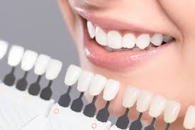 advanes of zoom teeth whitening