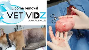 lipoma removal made simple clinical