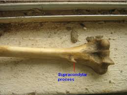 Disorder in which bones are porous and thin but bone composition is normal. One Of The 40 Humeri Possesses A Spine Located On The Anteromedial Download Scientific Diagram