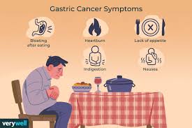 gastric cancer types symptoms causes