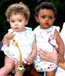 twins with diffe skin colour one