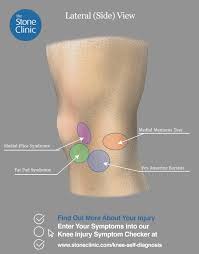 knee injury self diagnosis tool