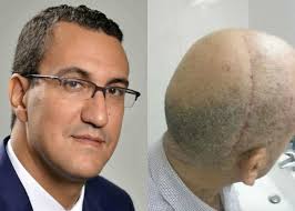 Le député M'jid El Guerrab sera jugé pour une violente agression à coups de casque - FL24.net
