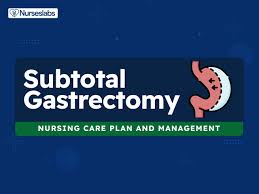 subtotal gastrectomy nursing care plan