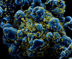 Jun 26, 2021 · the delta coronavirus variant, first identified in india, appears to be dominating new infections in south africa, local scientists told a news conference on saturday. South Carolina Sees First U S Cases Of South Africa Coronavirus Variant