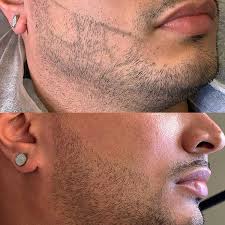 men s microblading beard and mustache
