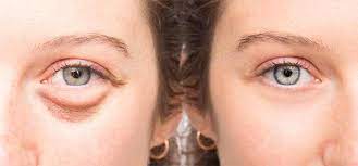 castor oil for eyes 9 surprising