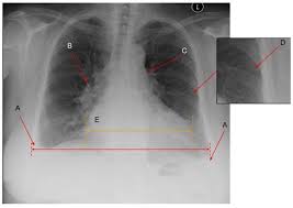 Arm Free Full Text Diagnosing Lung
