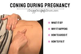 abdominal coning during pregnancy the