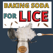using baking soda for lice my lice advice