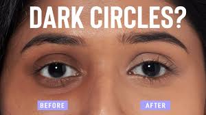 home remes to remove dark circles