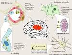 neuroinflammation