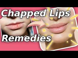 chapped ed lips home remes