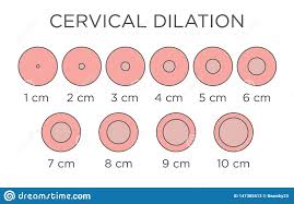 Cervial Dilation Medical Illustration Chart In Centimeters