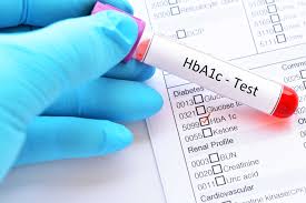 Hba1c Test For Diabetes Diagnosis Target Hba1c Home Tests