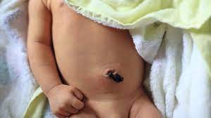 umbilical cord in newborns how to care