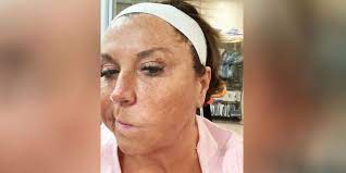 abby lee miller shows freckles in rare