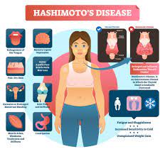 lose weight with low thyroid