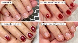 gentle sac removal and manicure