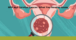 hpv and cervical cancer what you need