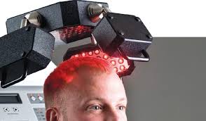 We can safely use these lights to promote hair restoration for patients with androgenic alopecia (female pattern hair loss), traction alopecia, and telogen effluvium. Laser Hair Loss Treatment Majestic Derma