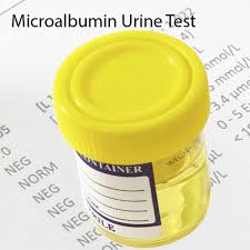 Microalbumin Or Urine Microalbumin Test Urine Microalbumin