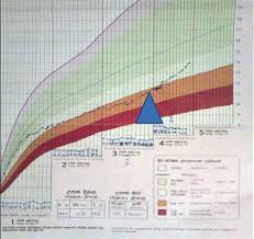 Nutritional Status In Sri Lanka Determinants And