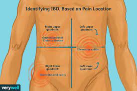 what inflammatory bowel disease pain