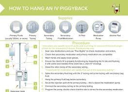Iv Piggyback Guide Free Cheat Sheet