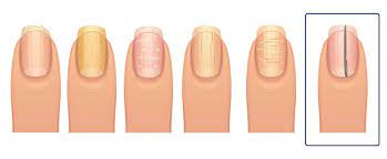 your fingernails say about your health