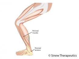 The problem was that this patient believed that she had a tendon rupture and that it needed surgery, so she went that direction. Lower Leg Pain And Injuries Information Sinew Therapeutics