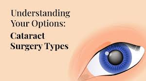 cataract surgery types options and