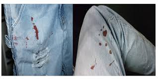 dried paint stains from your jeans