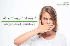 what causes cold sores utah valley