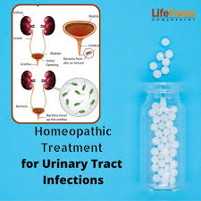 homeopathic treatment for utis natural