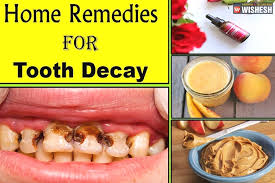 home remes for cavity and tooth decay