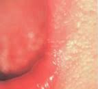 skin disorders in the mouth lips