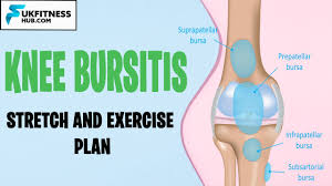 knee bursitis stretches and exercises