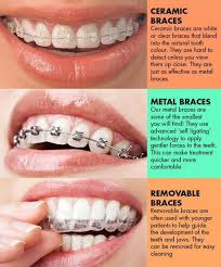 Teeth whitening and the various methods available and their costs, in addition to how you can whiten teeth with braces. Orthodontics For Adults Fraser Dental Hobsonville Auckland